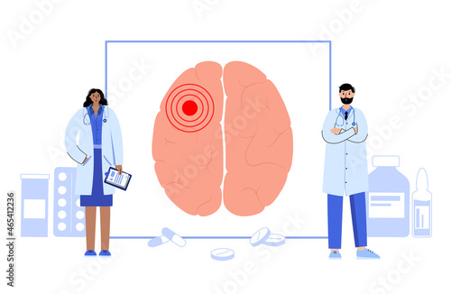 epilepsy seizure or headache