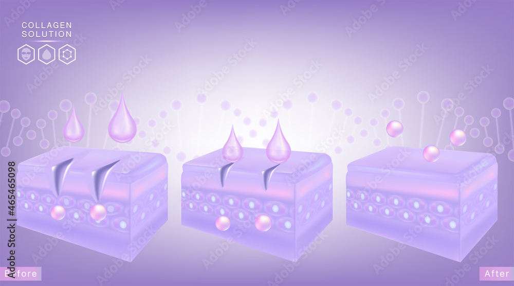 Hyaluronic acid before and after skin solutions ad, purple collagen serum drops with cosmetic advertising background ready to use, illustration vector. Hyaluronic acid before and after skin solutions ad, purple collagen serum drops with cosmetic advertising background ready to use, illustration vector.