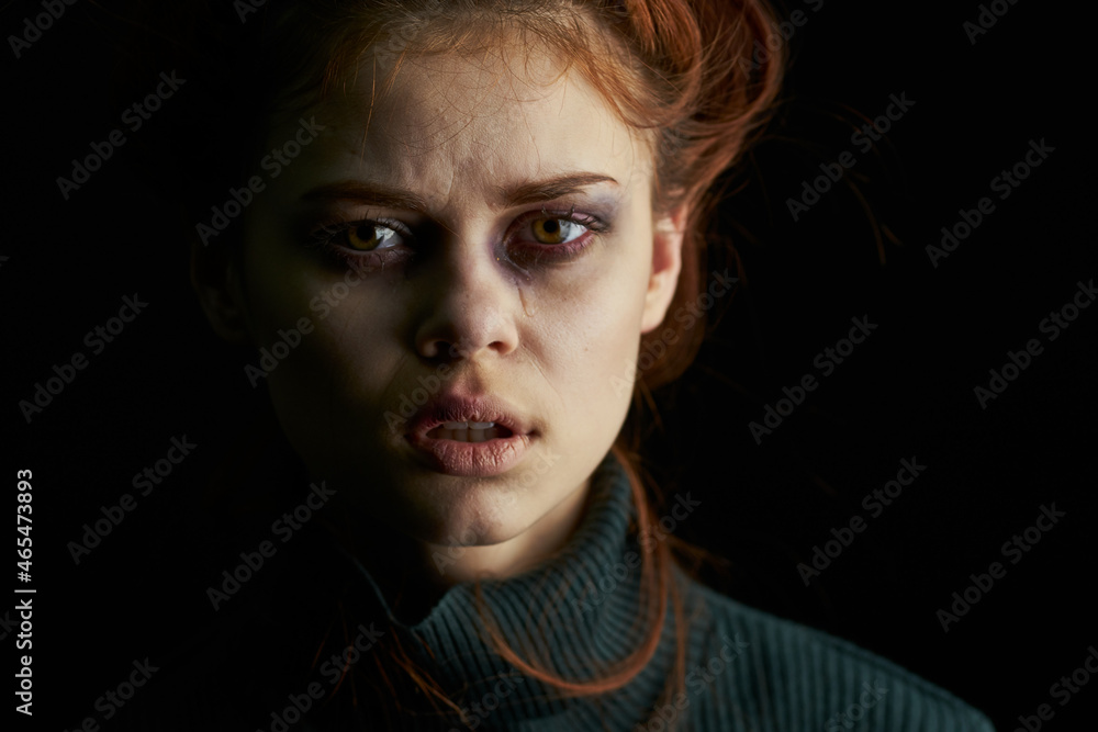 scared upset woman with bruises under eyes problems abuse depression scared upset woman with bruises under eyes problems abuse depression