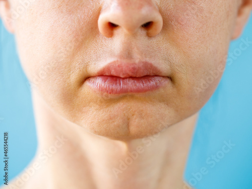 Tableau sur toile Teeth Problem
