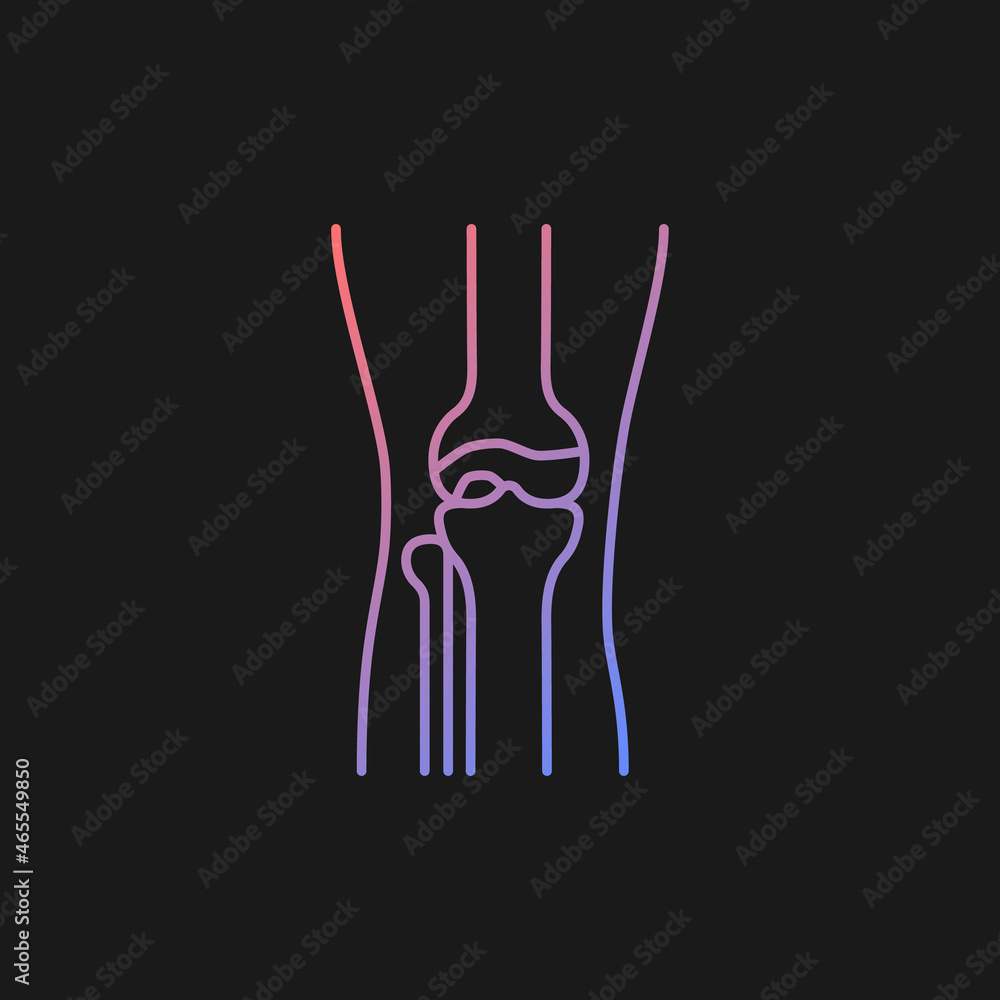 Osteoarthritis gradient vector icon for dark theme. Cartilage inflammation. Degenerative joint disease. Pain in knee. Thin line color symbol. Modern style pictogram. Vector isolated outline drawing Osteoarthritis gradient vector icon for dark theme. Cartilage inflammation. Degenerative joint disease. Pain in knee. Thin line color symbol. Modern style pictogram. Vector isolated outline drawing