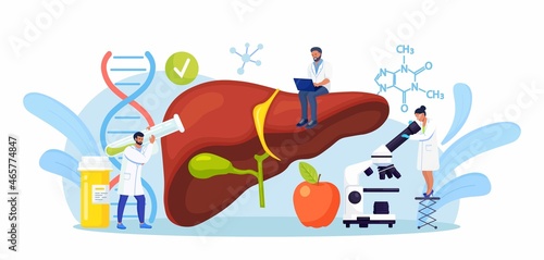 Tiny Doctors Treat the Liver Disease. Medical Diagnosis of Hepatitis A, B, C, D, Cirrhosis. Group of Doctors Examining Patient Inner Organs, Performing Lab Tests, Biopsy, Molecular Analysis. Vector 