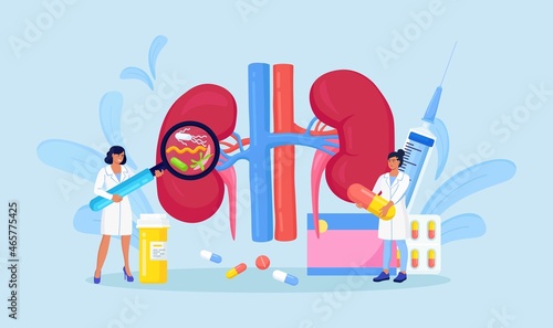 Pyelonephritis. Tiny Doctors Nephrologist Diagnosing and examining Patient with Kidney Renal Disease, Urine Test, Diagnostic. Doctors check health of kidneys. Nephrology inner organs treatment. Vector
