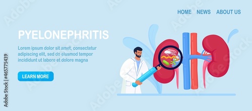 Tiny Doctors Nephrologist Diagnosing Pyelonephritis Disease. Hospital Diagnostic, Treatment of Kidney. Physician with Magnifying Glass. Urology and Nephrology, Nephroptosis, Renal Failure, Cystitis. 