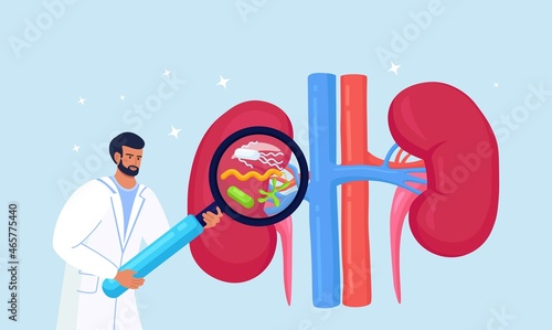 Tiny Doctors Nephrologist Diagnosing Pyelonephritis Disease. Hospital Diagnostic, Treatment of Kidney. Physician with Magnifying Glass. Urology and Nephrology, Nephroptosis, Renal Failure, Cystitis.