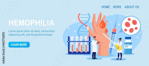 Hemophilia. Tiny doctors examine the blood non-coagulability. Hand with a bleeding, unhealed wound. Physician treat the patient with anemia, blood disease. Detailed test for red blood cells, platelets