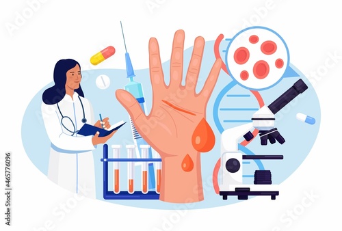 Hemophilia. Doctor examine the blood non-coagulability. Hand with a bleeding, unhealed wound. Physician treat the patient with anemia, blood disease. Detailed test for red blood cells, platelets