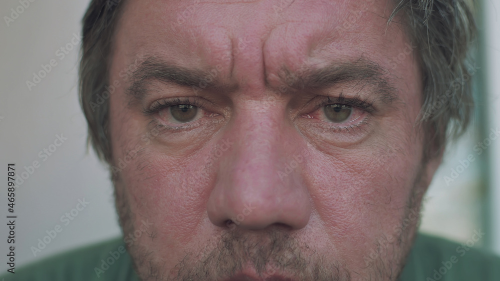 Obraz premium portrait of a homeless alcoholic man with red eyes and a swollen unshaven face close-up looks at the camera