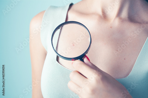 woman holding a magnifying glass. pimple on the body