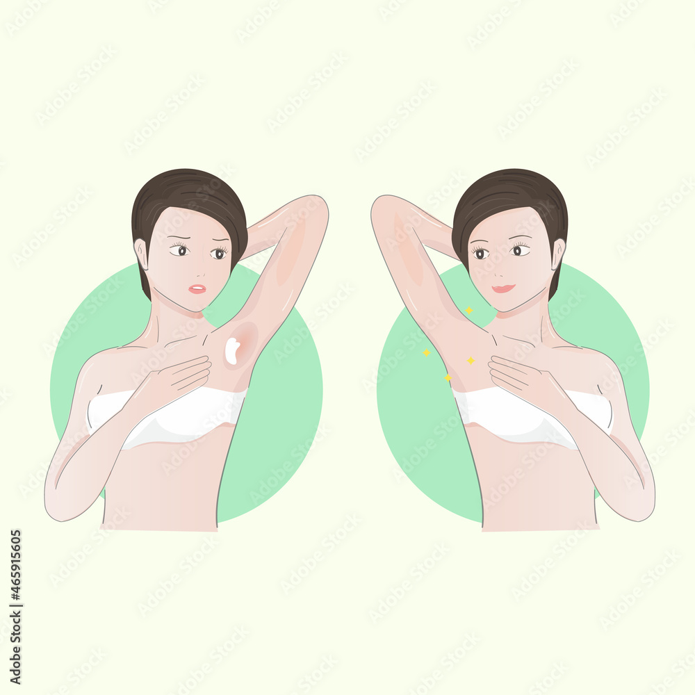 illustration Armpit hair care. before and after. illustration Armpit hair care. before and after.