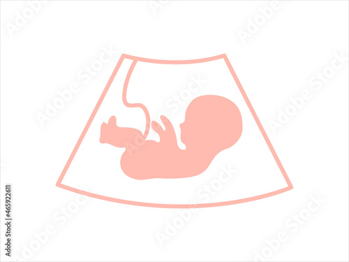 Ultrasound examination procedure. Baby in womb. Pregnancy and health of child. 

Embryo and umbilical cord on screen.  Medical symbol for pregnancy center. 
Vector illustration