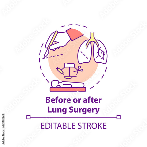 Obraz na plátně Before and after lung surgery concept icon