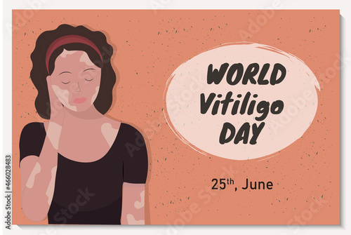 Banner with beautiful young woman with vitiligo desease, flat vector illustration