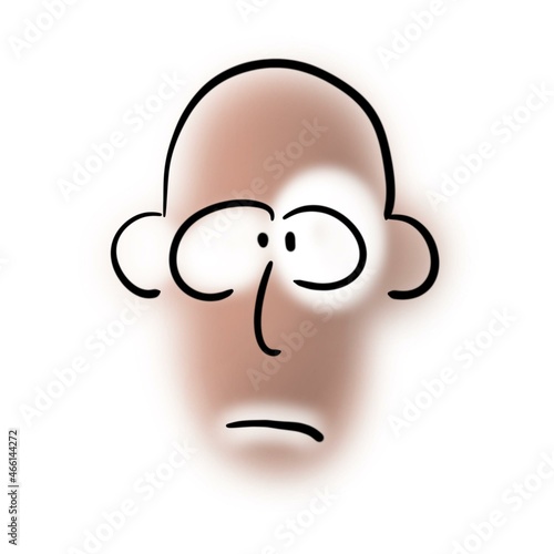 Bald man with vitiligo on his face