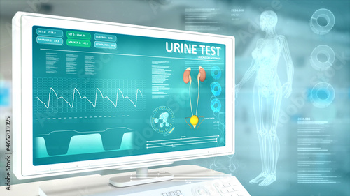 test of urine - women health composition with overlays , industrial 3D illustration
