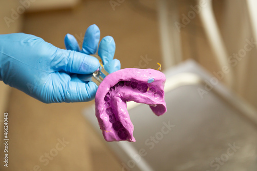 Close up view of dentist hand holding silicone jaw imprint photo