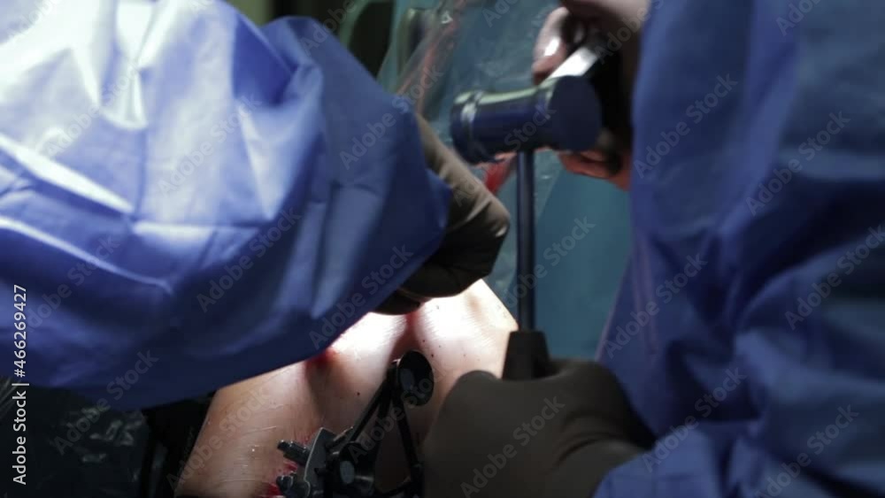 Surgeons perform the operation with a modern robot.
Surgeons perform the operation with a modern robot.
