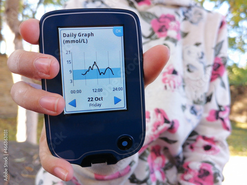 фотографія Girl with diabetes is reading the glucose levels using device for continuous glucose monitoring in blood – CGM