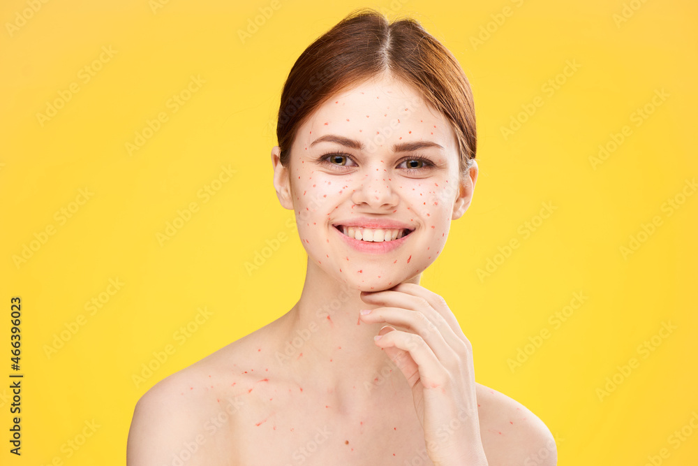 woman-with-bare-shoulders-red-dots-on-her-face-health-problems