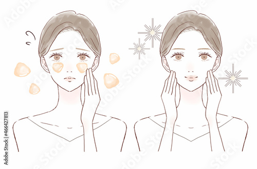 脂性肌（オイリー肌）に悩む女性のビフォーアフター