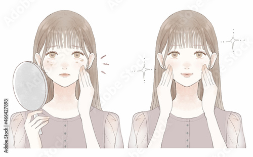 シミに悩む女性のビフォーアフター