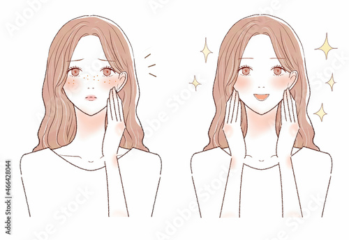 そばかすを気にする女性のビフォーアフター
