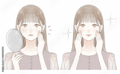 そばかすを気にする女性のビフォーアフター