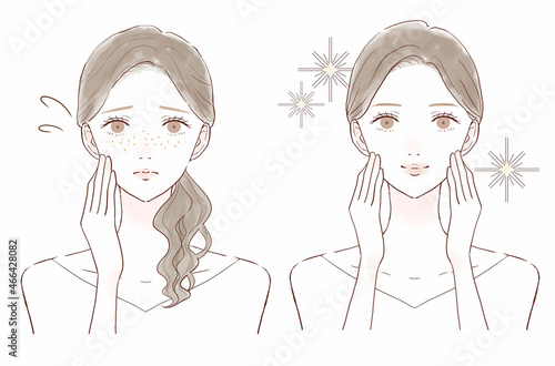 そばかすを気にする女性のビフォーアフター