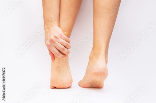 Fototapeta Naklejka Na Ścianę i Meble -  Foot pain from uncomfortable shoes. Female feet with flaky skin and corns isolated on a white background. A woman holds a sore heel with her hand. Pathology of bone structures, flat feet. Orthodontics