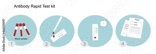 The method or protocol of Antibody rapid test kit to detect the Antibody against the viral infection such as SARS-CoV-2 (COVID-19) or other virus in briefly
