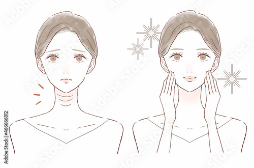 首のしわに悩む女性のビフォーアフター