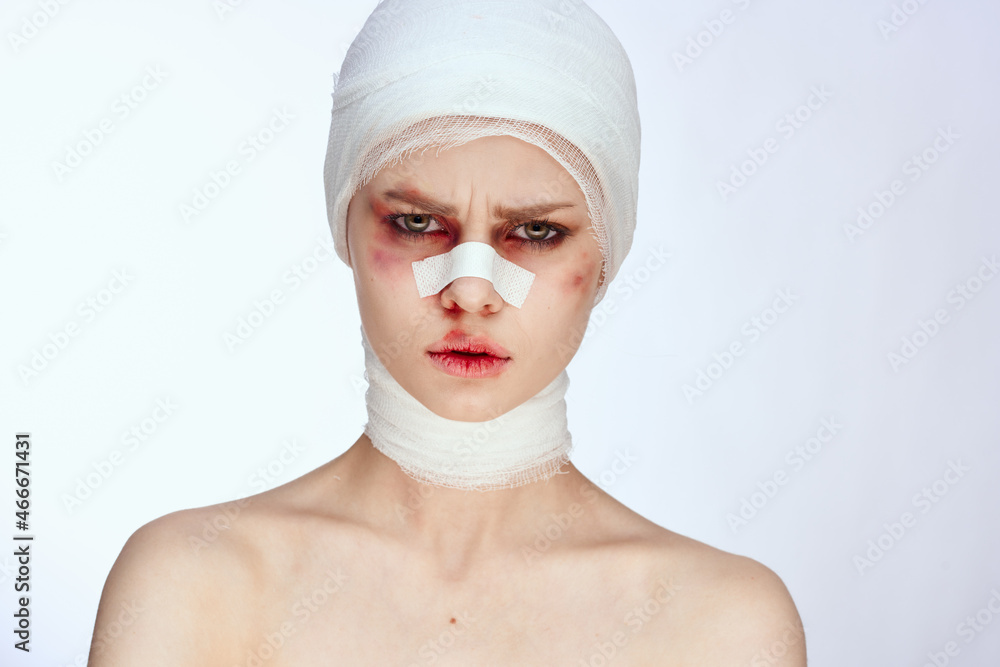 emotional woman bruised face medicine treatment injury close-up emotional woman bruised face medicine treatment injury close-up