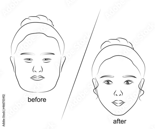 Woman face on isolated background. Plastic surgery. Vector illustration.