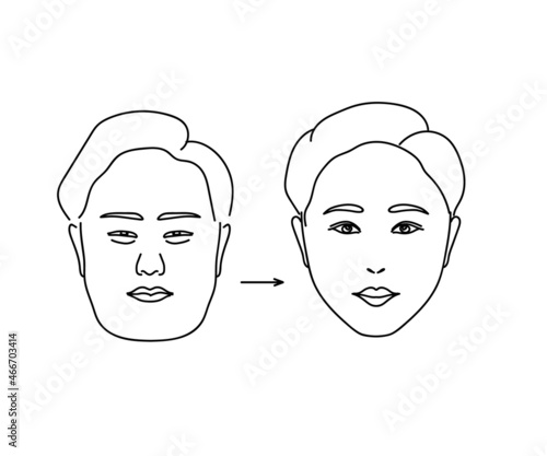 Woman face on isolated background. Plastic surgery. Vector illustration.
