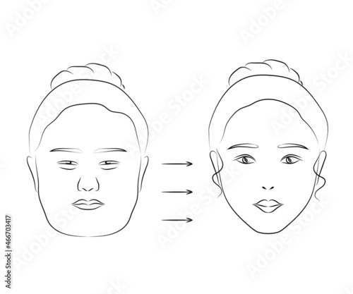 Woman face on isolated background. Plastic surgery. Vector illustration.