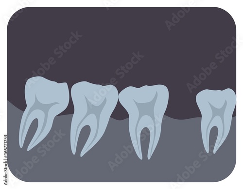 Intraoral radiograph of human teeth and gingiva. Dental x-ray picture or radiographic monitor image, side view. Medical radiology in dentistry. Monochrome vector illustration in flat cartoon style
