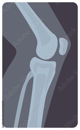 Lateral radiograph of human knee joint. Monochrome x-ray picture or radiographic monitor image of leg part, side view. Medical radiology of limb. Modern vector illustration in flat cartoon style