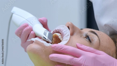 Close Up Of Orthodontist Scaning Patient's Teeth With Dental Intraoral Scanner. Healthcare And Stomatology Concept.