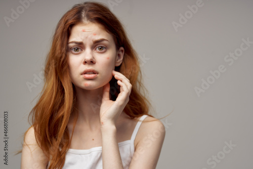  beautiful woman in a white t-shirt pimples on the face isolated background