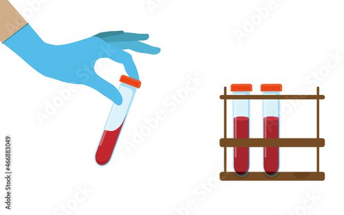 Flasks with blood components a test tube with blood, a medical test tube in the hands of a medical worker.