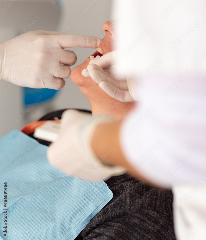 paciente es sometido a una intervención odontológica en una clínica dental  - obrazy, fototapety, plakaty 