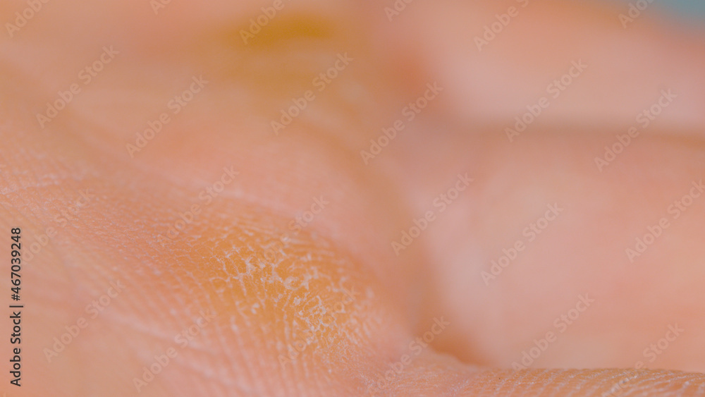 Fototapeta premium MACRO, DOF: Callouses formed on the palm of an unrecognizable male climber.