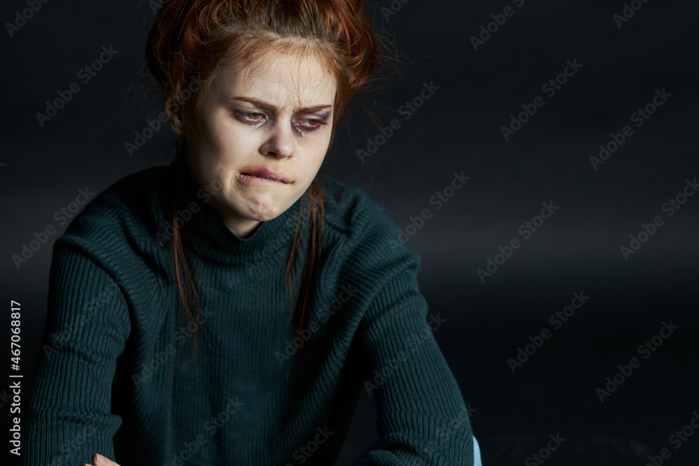 emotional women with black eye abuse discontent depression emotional women with black eye abuse discontent depression