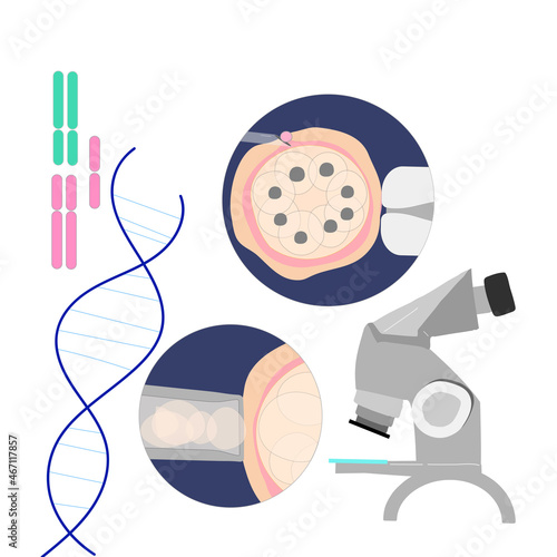 Vector colored illustration of PGD preimplantation genetic screening of embryon or morula oocyte