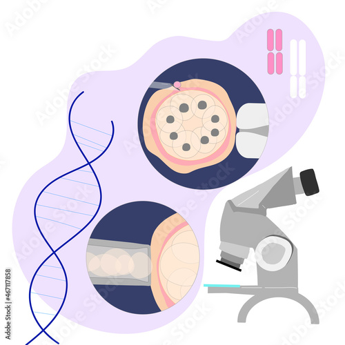 Vector colored illustration of PGD preimplantation genetic screening of embryon or morula oocyte