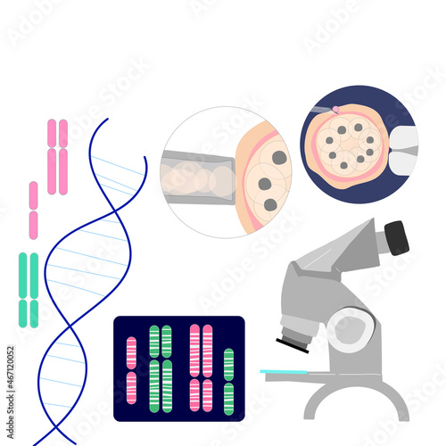 Vector colored illustration of PGD preimplantation genetic screening of embryon or morula oocyte