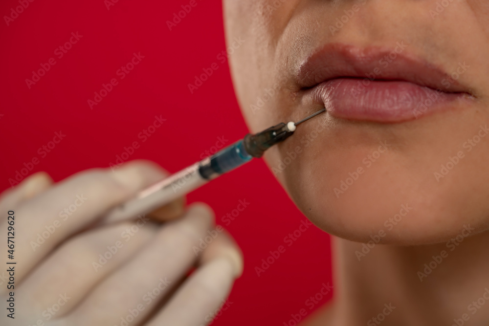 Close up of a young woman on a face filler injection procedure