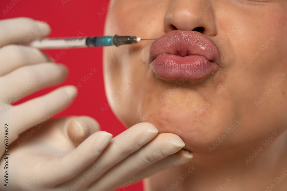 Close up of a young funny woman on a face filler injection procedure