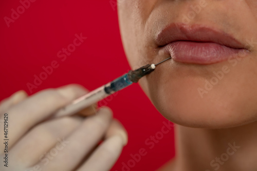 Close up of a young woman on a face filler injection procedure