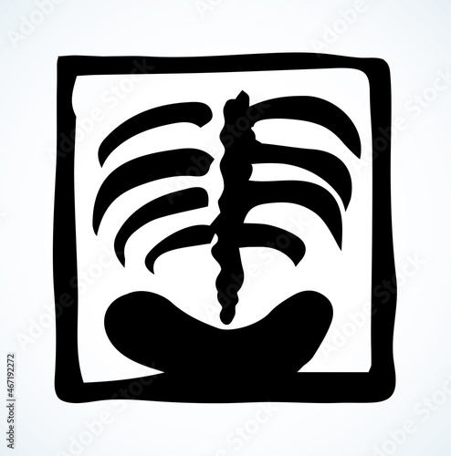 X-ray of the ridge. Vector drawing